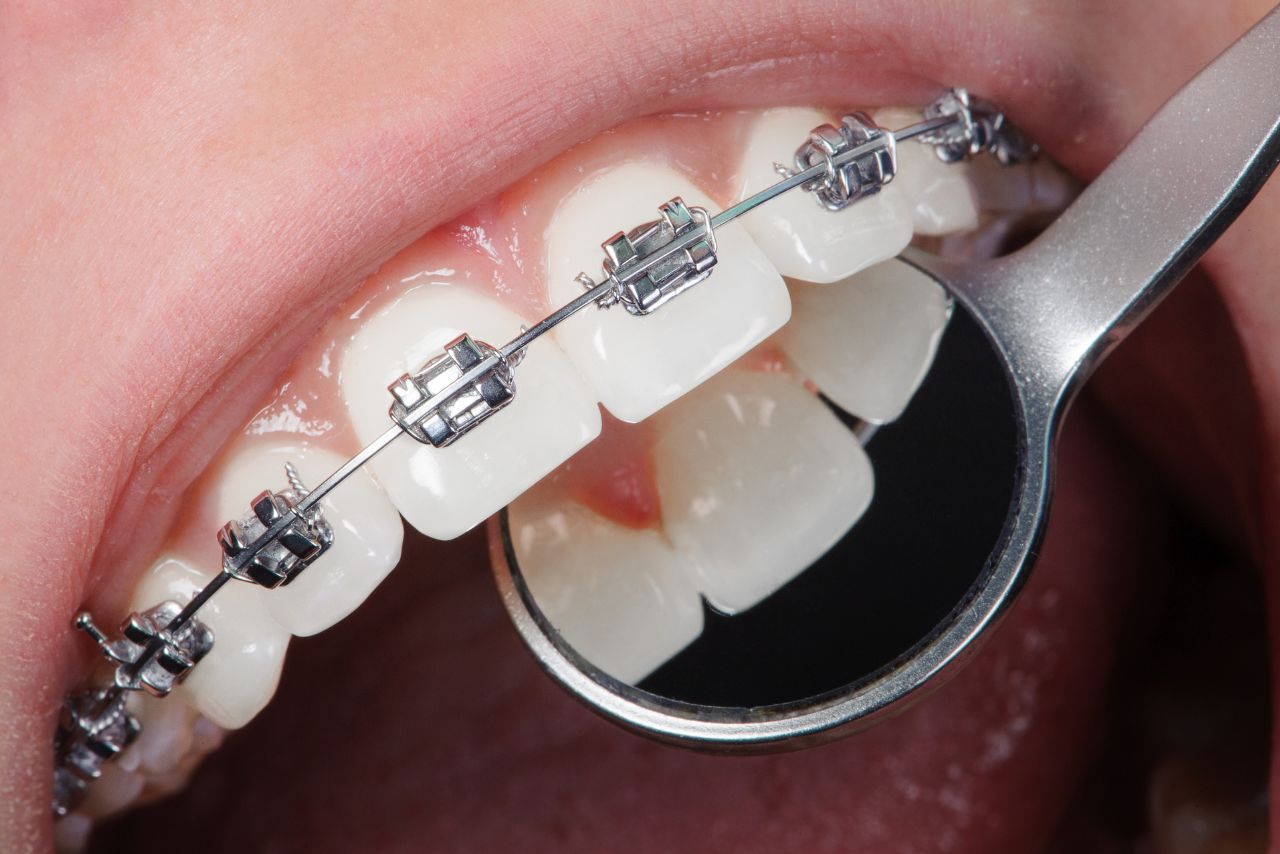 Ortodonzia white studio dentistico a cagliari