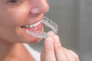 Ortodonzia white studio dentistico cagliari